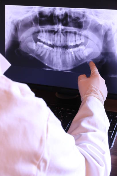 Best Walk-In Emergency Dentist in Nashvle, IL
