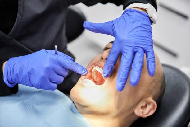 Best Emergency Root Canal Treatment in Nashvle, IL