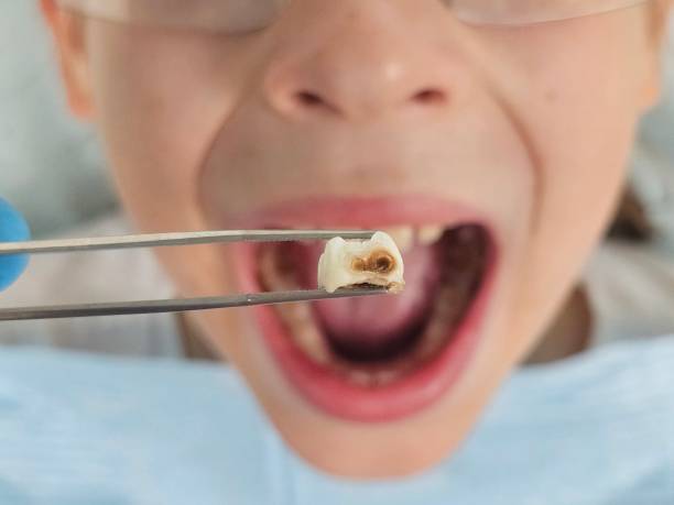 Best Pediatric Emergency Dentist in Nashvle, IL